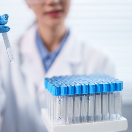 Lab tubes being processed