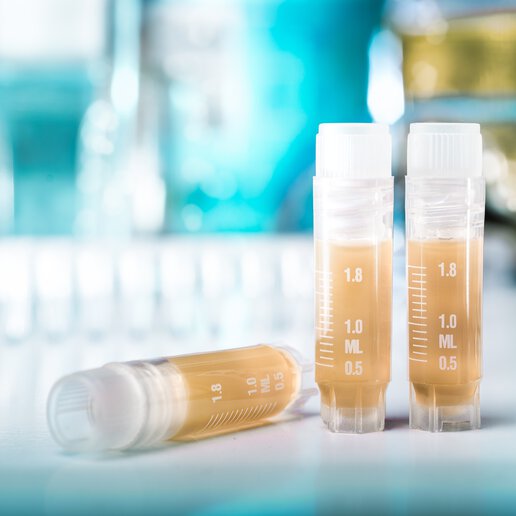 three samples in test tubes prepared through aliquoting
